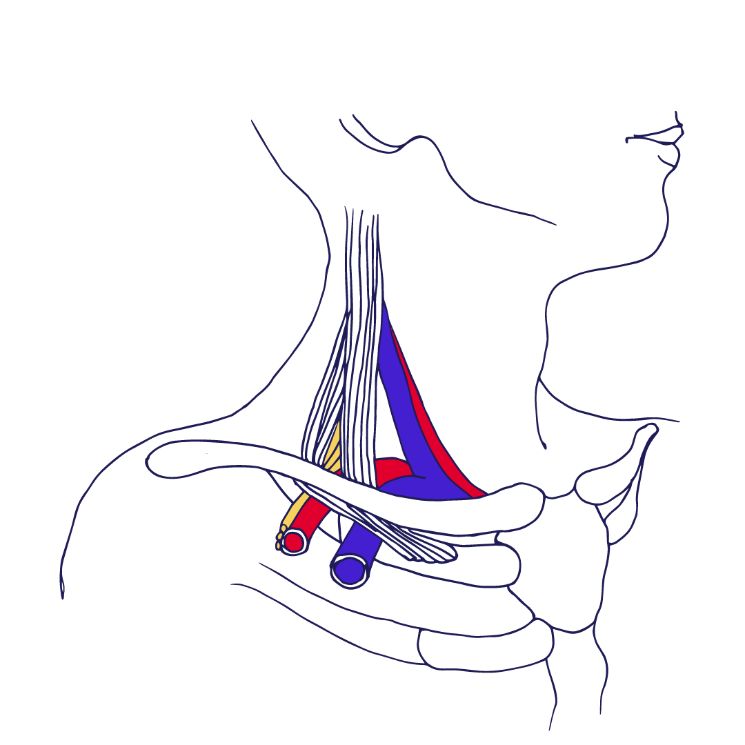 Thoraxapertursyndromets anatomi i schematisk skiss